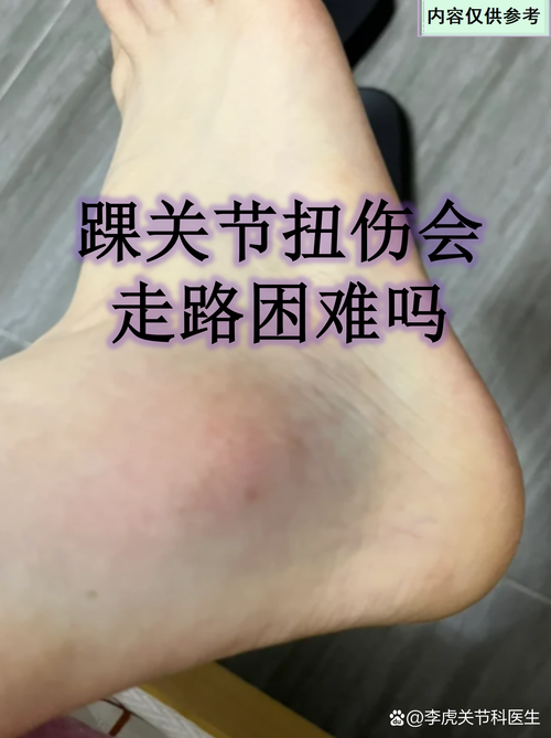 队记：迪恩韦德热身时疑似扭伤了脚踝目前不清楚伤势程度